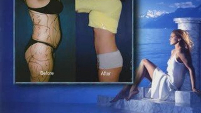 Riverside Liposuction - Liposuction in Riverside Ca.