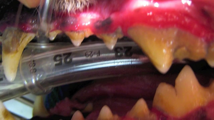 Dental Video.mov