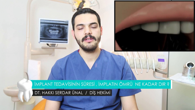 İmplant tedavisinin süresi, implantın ömrü ne kadardır? - Dt. Hakkı Serdar Ünal