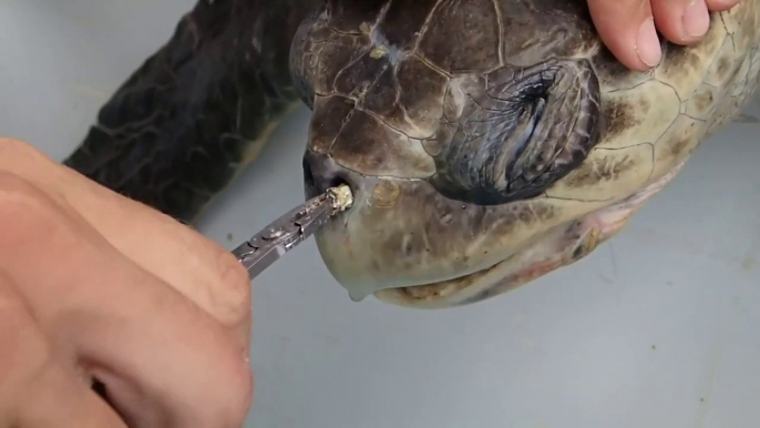 Sea Turtle with Straw up its Nostril - NO TO PLASTIC STRAWS