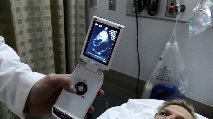 ASM-1 Vscan Demo- heart, lung, gallbladder, aorta