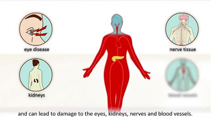 Diabetes Mellitus Overview : Signs and Symptoms of Diabetes Mellitus