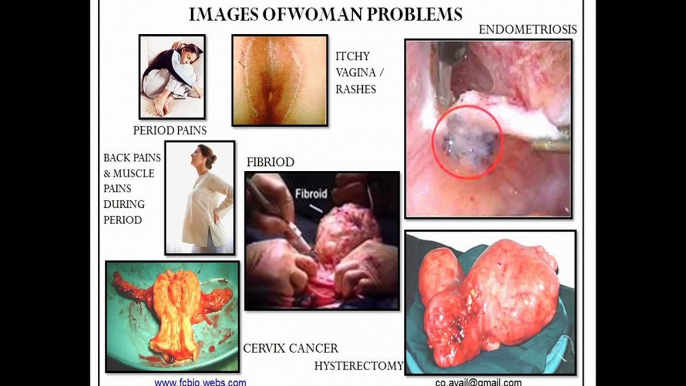 The Dangers of Normal Pads&Pantyliner. Its contains the toxic DIOXIN!! Save Yourself!!