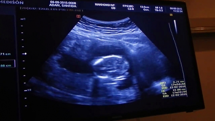 Boy or Girl? Nong Baby 16 week Ultrasound (raw)