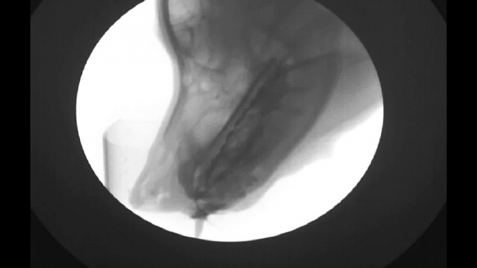 X-ray video of drinking dog