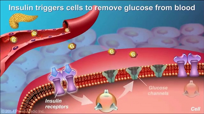 Type 2 Diabetes - Causes, Symptoms, Diagnosis & Treatments