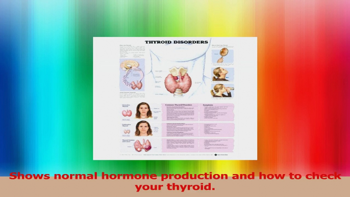 Thyroid Disorders Anatomical Chart PDF