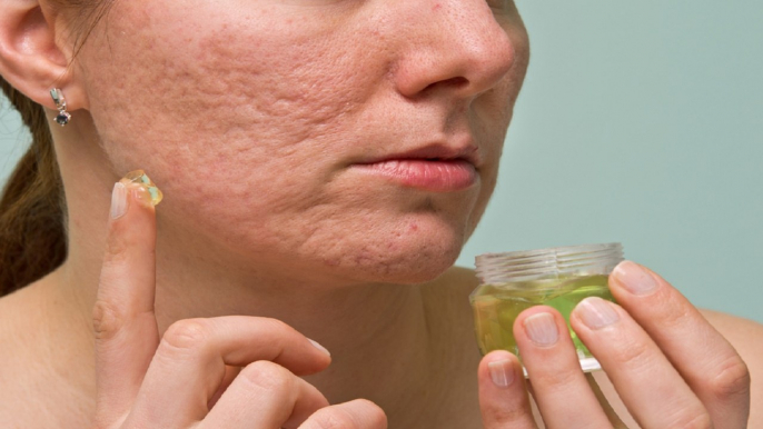 How to Reduce Pimples and Dark Spots.