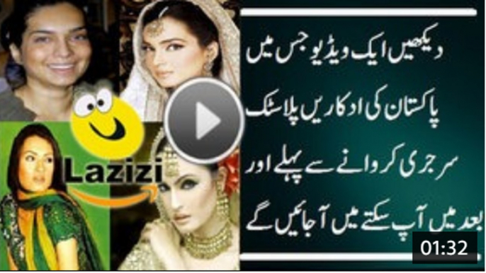 Pakistani Actresses Before and After Plastic Surgery Will Shock You