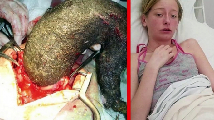 10 Horrifying Things Ever found Living Inside a Human Body [HD]