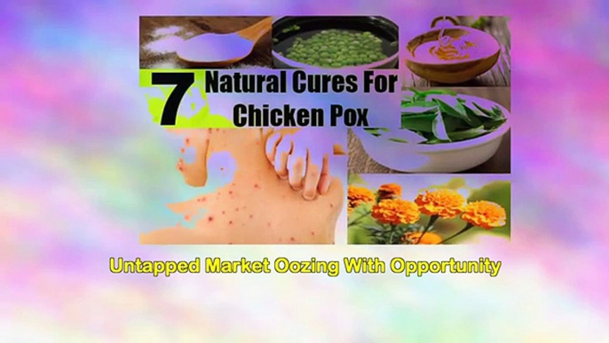 Fast Chicken Pox Cure