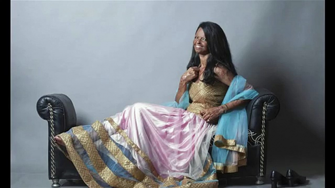 Acid Attack Survivor Becomes Face Of Fashion Brand In India