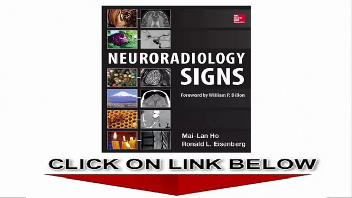 Neuroradiology Signs