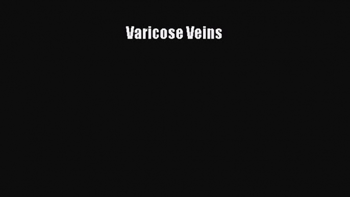 Download Varicose Veins Ebook Online