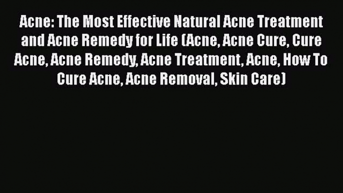 Read Acne: The Most Effective Natural Acne Treatment and Acne Remedy for Life (Acne Acne Cure