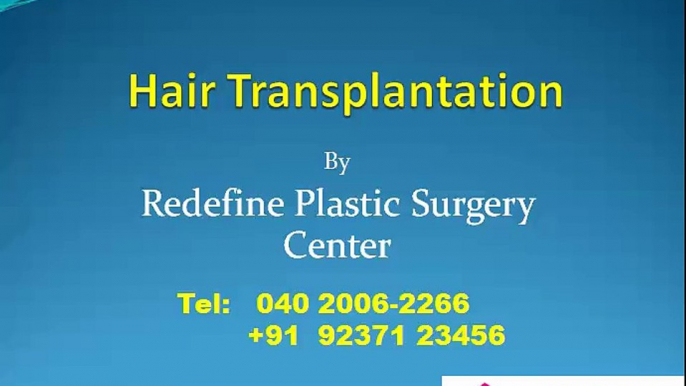 Hair Transplantation in Hyderabad | Hair Transplantation Surgery Cost in Hyderabad