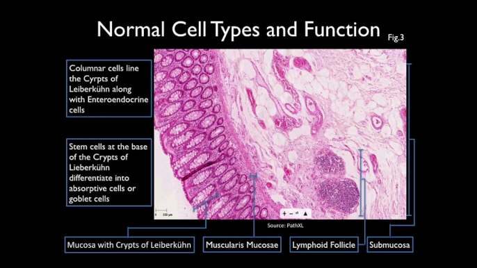 Cancer Biology: Part 3 of Dossier by Chelsea Dias