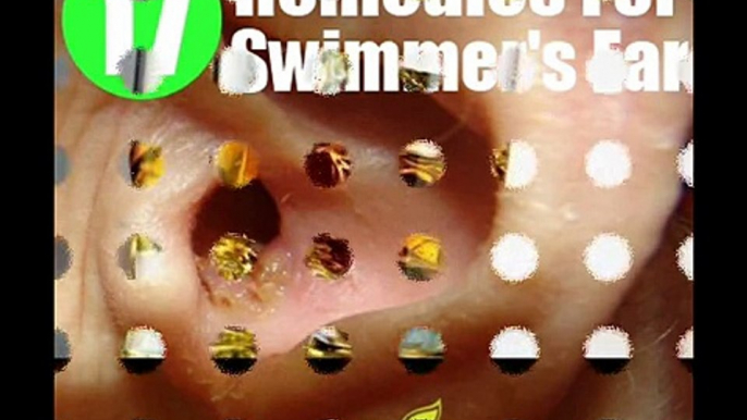 17 Home Remedies For Swimmer's Ear