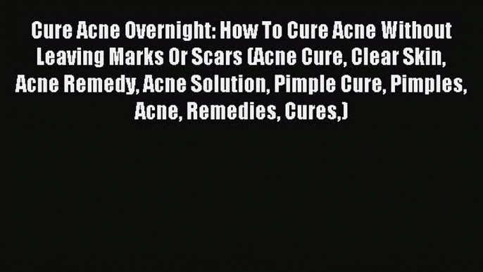 READ book Cure Acne Overnight: How To Cure Acne Without Leaving Marks Or Scars (Acne Cure