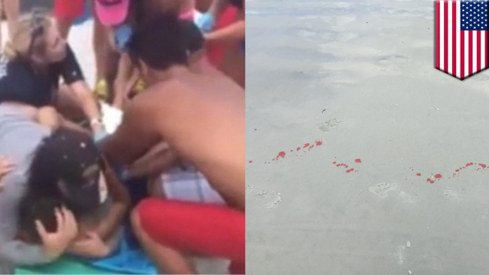 Shark attack! 13 year old Florida boy critically injured by shark