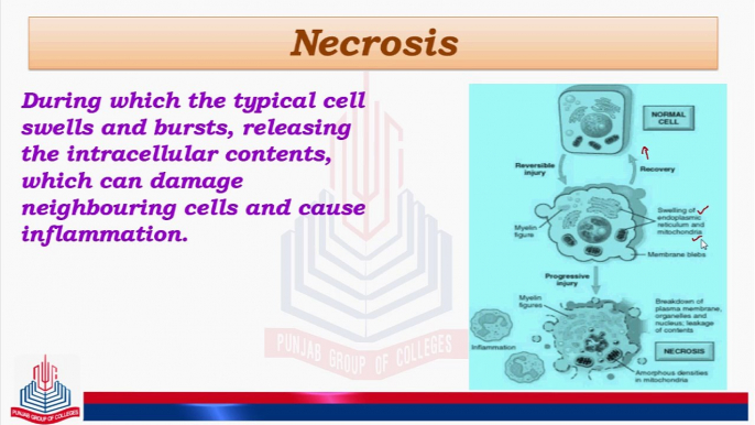 Necrosis