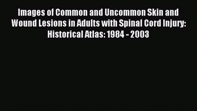 Download Images of Common and Uncommon Skin and Wound Lesions in Adults with Spinal Cord Injury: