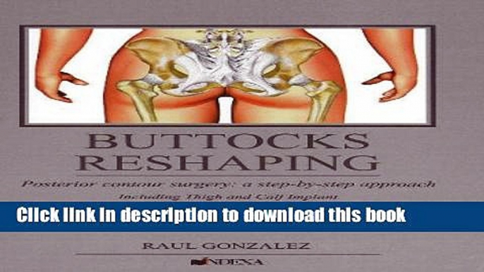 Read Buttocks Reshaping: Posterior Contour Surgery: A Step-by-step Approach Including Thigh and