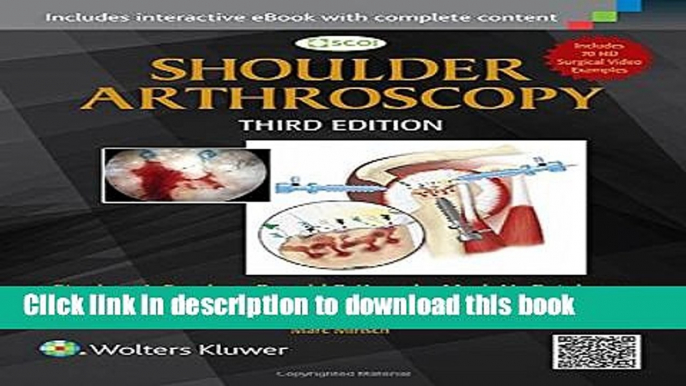 Download Shoulder Arthroscopy [Download] Online