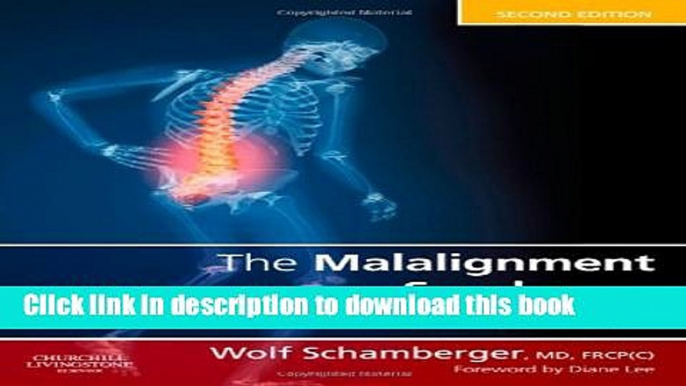 Books The Malalignment Syndrome: diagnosis and treatment of common pelvic and back pain, 2e Free