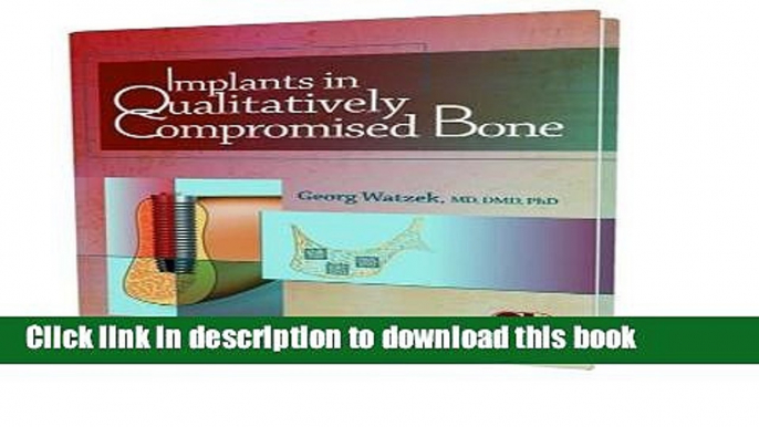 Books Implants In Qualitatively Compromised Bone Free Download