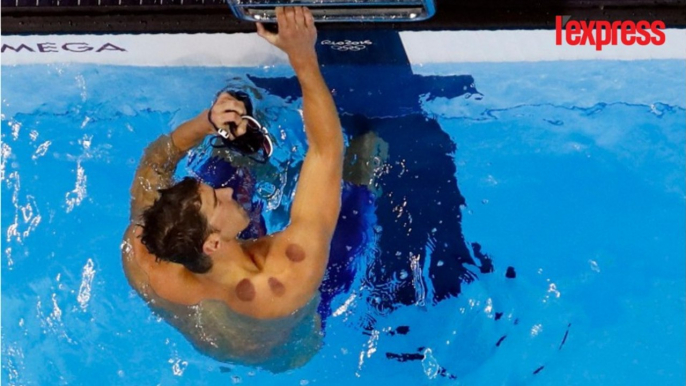 JO 2016: Mais que sont ces cercles rouges sur le dos de Michael Phelps?