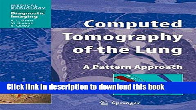 Download Computed Tomography of the Lung: A Pattern Approach (Medical Radiology) E-Book Online