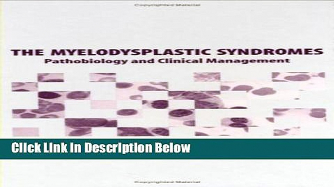 Ebook The Myelodysplastic Syndromes: Pathobiology and Clinical Management (Basic and Clinical