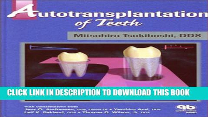 [Download] Autotransplantation of Teeth Hardcover Collection