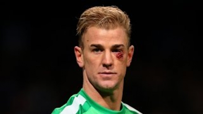 Top 10 Super goals vs Joe Hart • Unlucky guy