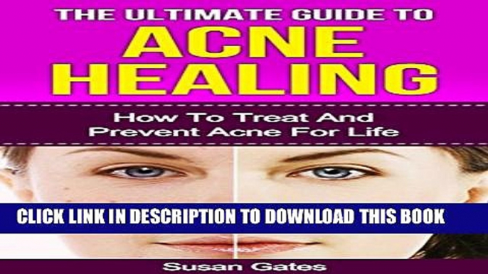 [PDF] Acne Healing: How To Treat And Prevent Acne For Life (Acne Cure, Acne Remedy, Acne Scar