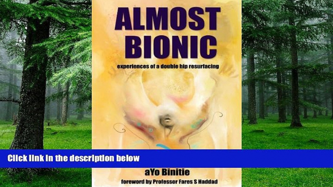 Big Deals  Almost Bionic, experiences of a double hip resurfacing  Best Seller Books Most Wanted