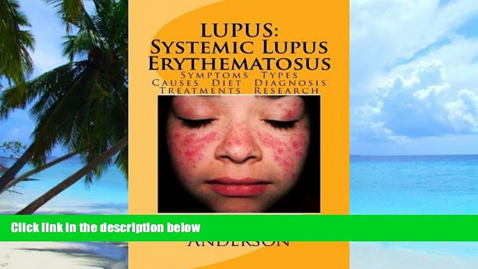 Must Have PDF  LUPUS:  Systemic Lupus Erythematosus: Symptoms. Types. Causes. Diet.  Diagnosis.