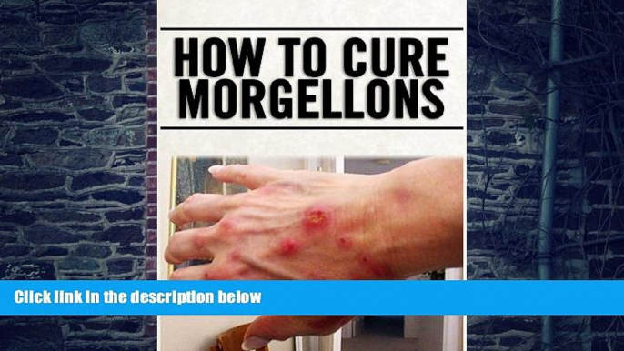 Big Deals  How To Cure Morgellons  Free Full Read Best Seller