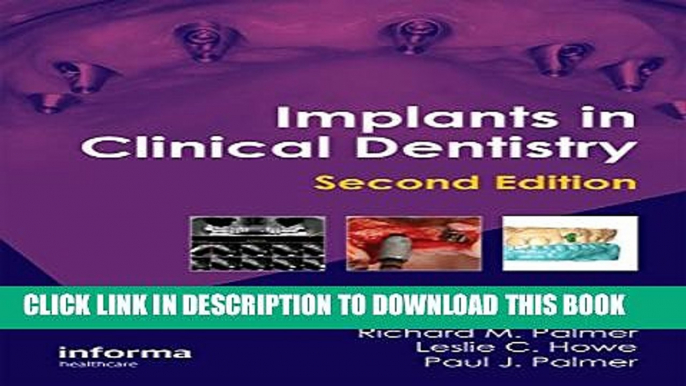 New Book Implants in Clinical Dentistry, Second Edition