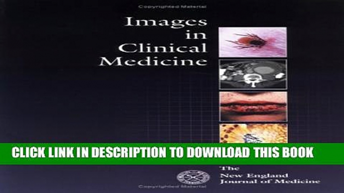 [PDF] Images in Clinical Medicine: Selections from The New England Journal of Medicine Popular