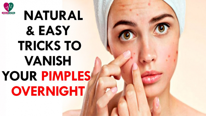 Natural & easy tricks to vanish your pimples overnight- Health Sutra