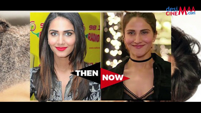 PLASTIC SURGERY GONE WRONG FOR THIS ACTRESS