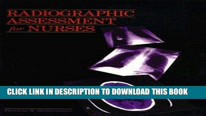 [READ] EBOOK Radiographic Assessment For Nurses, 1e ONLINE COLLECTION