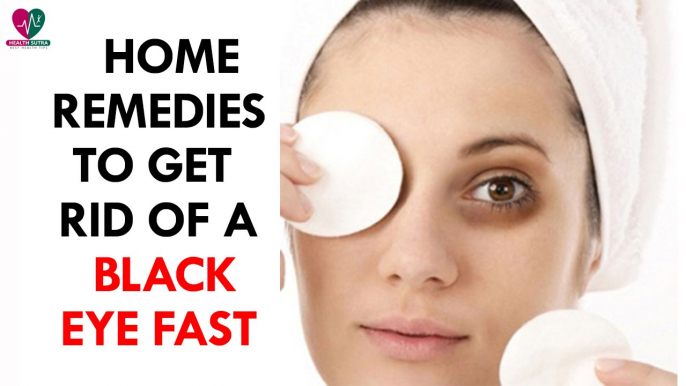 Home Remedies to Get Rid of a Black Eye Fast - Health Sutra