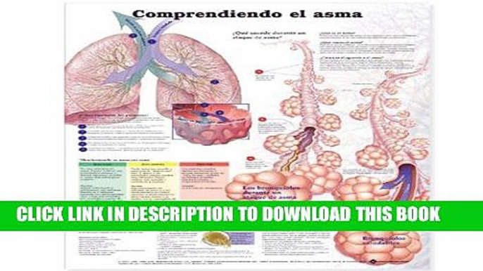 [READ] EBOOK Understanding Asthma Anatomical Chart in Spanish (Entendiendo El Asma) BEST COLLECTION