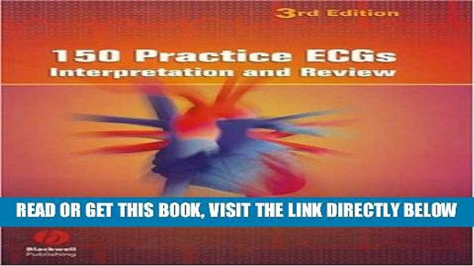 [FREE] EBOOK 150 Practice ECGs: Interpretation and Review ONLINE COLLECTION