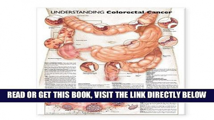 [READ] EBOOK Understanding Colorectal Cancer Anatomical Chart ONLINE COLLECTION