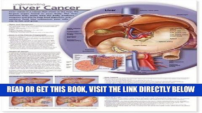 [FREE] EBOOK Understanding Liver Cancer Anatomical Chart BEST COLLECTION