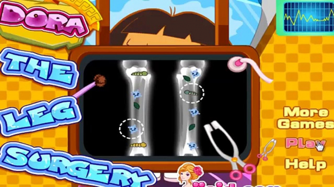 Dora The Explorer Doctor Caring - Dora Leg Surgery Doctor Games For Kids